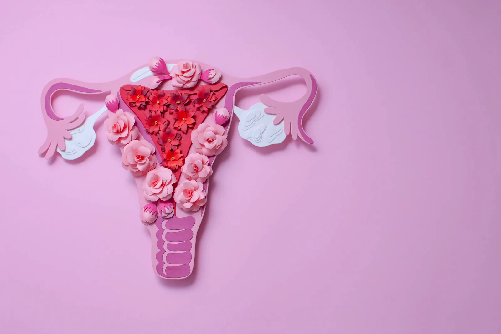 Somp reúne alterações hormonais, metabólicas e reprodutivas