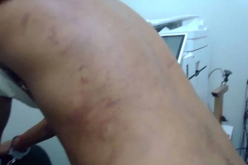 Relatos em presídios de Pernambuco apontam agressões atribuídas a chaveiros