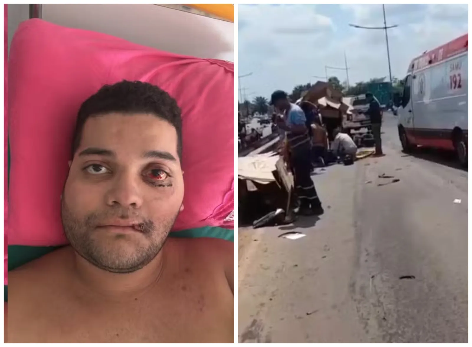 Motociclista deixa UTI após colisão entre motos em Rio Branco