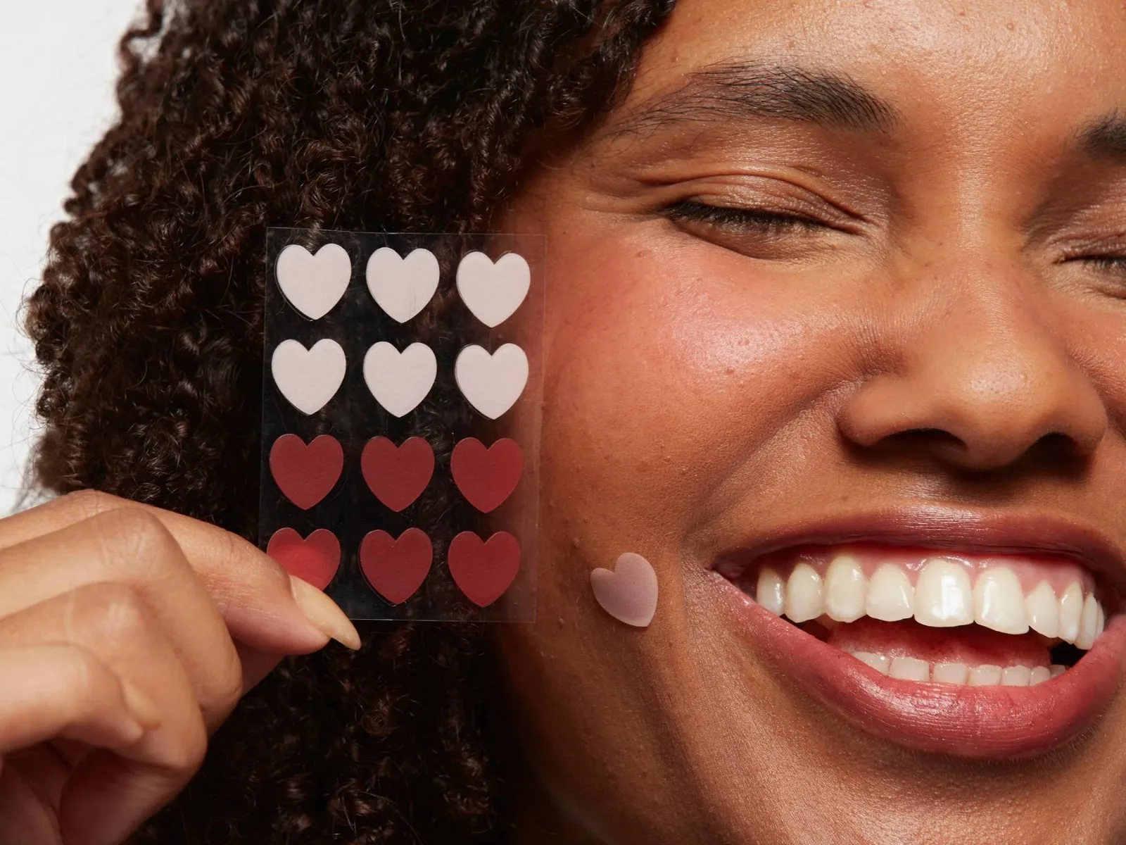 Adesivos para espinhas protegem a pele, mas não tratam a acne sozinhos